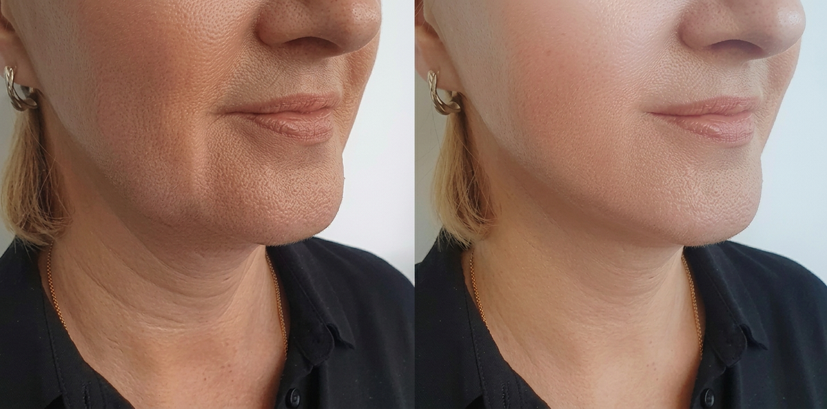 Before and after photo